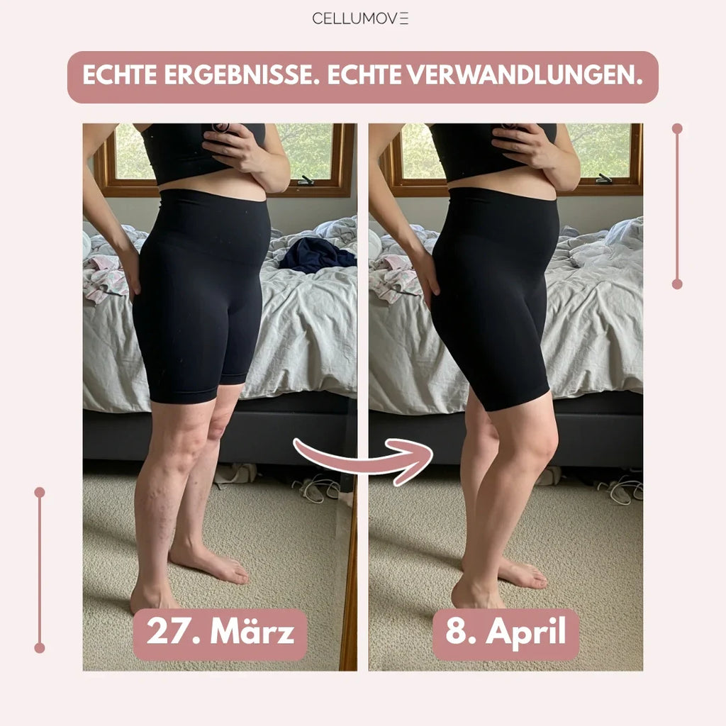 Cellumove 3D Legging – oder Geld zurück. Die Leggings nach der Schwangerschaft, auf die über 25.000 Mamas schwören.