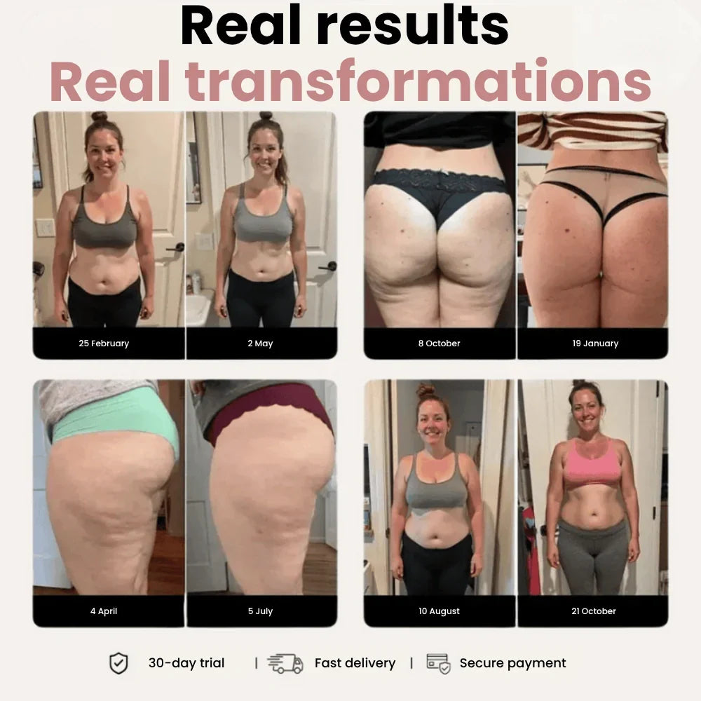 Cellumove 3D Leggings – Verabschieden Sie sich auf natürliche Weise von Lipödem-Schmerzen und Schwellungen.