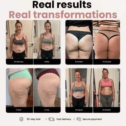 Cellumove 3D Leggings – Verabschieden Sie sich auf natürliche Weise von Lipödem-Schmerzen und Schwellungen.