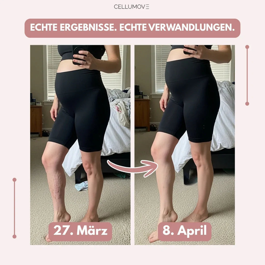 Cellumove 3D Legging – oder Geld zurück. Die Leggings nach der Schwangerschaft, auf die über 25.000 Mamas schwören.