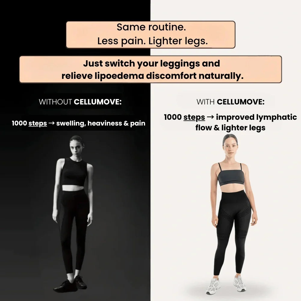 Cellumove 3D Leggings – Verabschieden Sie sich auf natürliche Weise von Lipödem-Schmerzen und Schwellungen.