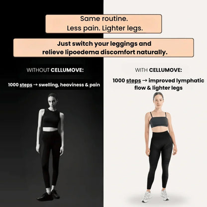 Cellumove 3D Leggings – Verabschieden Sie sich auf natürliche Weise von Lipödem-Schmerzen und Schwellungen.