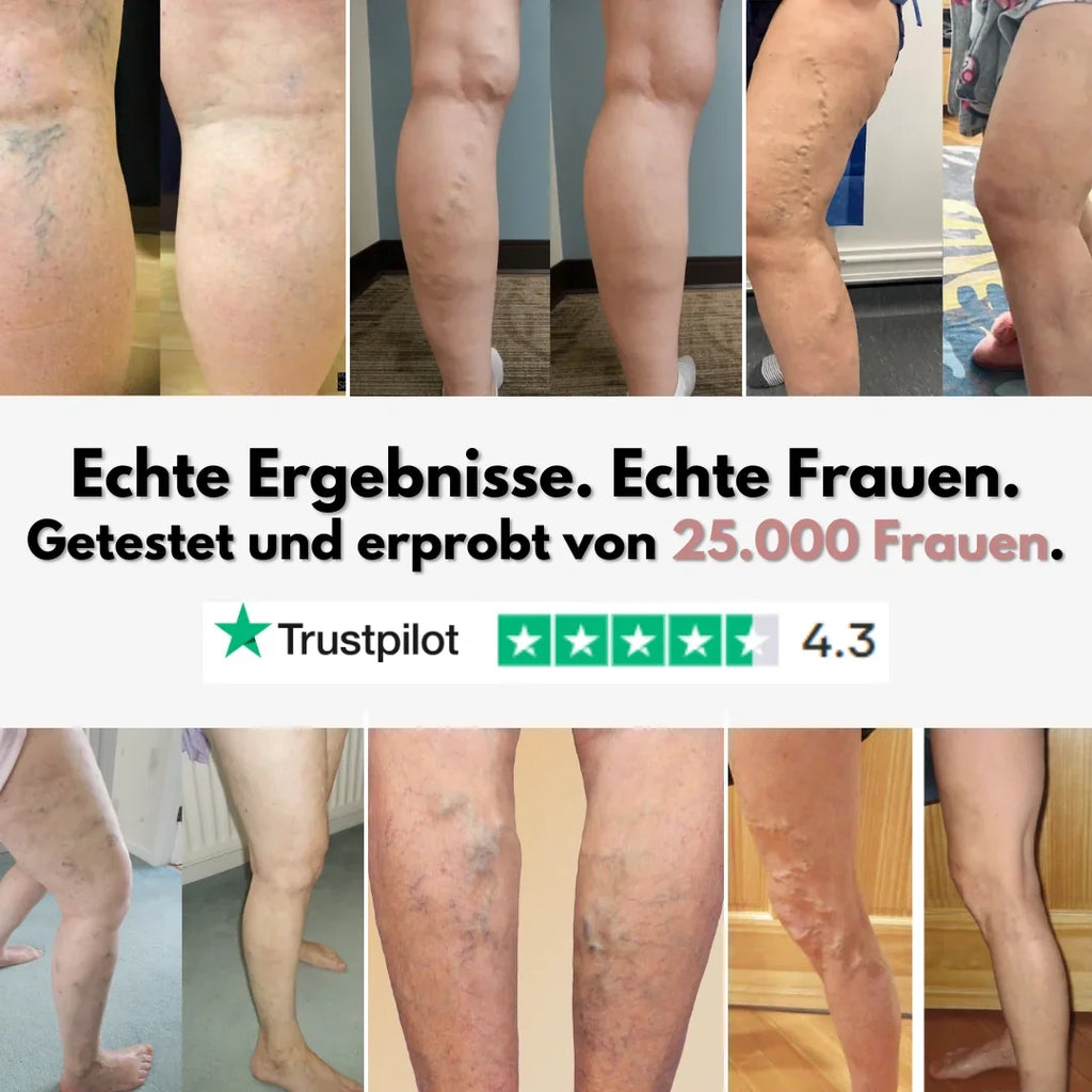 Cellumove 3D Legging – Entlasten und beugen Sie Krampfadern auf natürliche Weise vor.