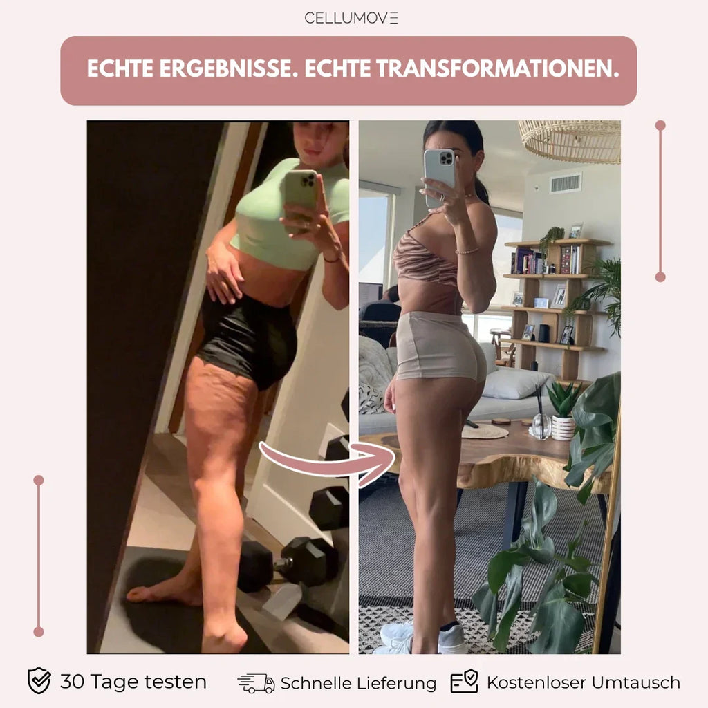 Anti-Cellulite-Leggings für Frauen, die schon alles versucht haben – sichtbare Ergebnisse in 14 Tagen