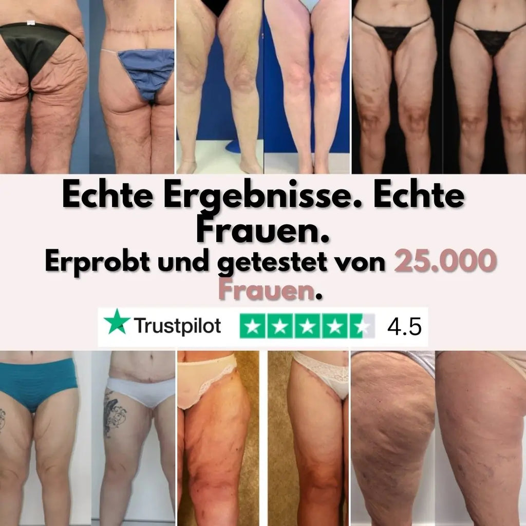 Firmer, smoother legs in 14 days — for women tired of being held back by sagging skin